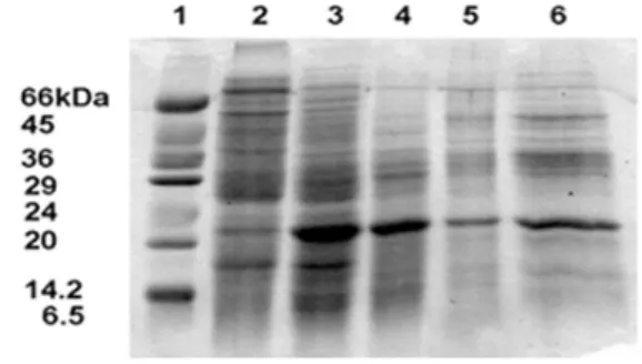 Fig.  4.  SDS-PAGE  analysis  of  protein  samples  from  various  stages  of  insoluble  neutral  invertase  purification