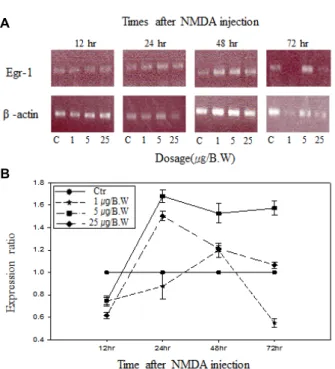 Fig.  3.  Expression  pattern  of  c-Jun  mRNA  in  total  mRNA  sam- sam-ples  by  RT-PCR  reactions