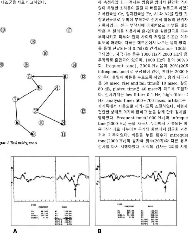 Figure 2. Event-related potential waveforms in response to frequent tones(left) and infrequent tones(right) in a normal control(A) and a patient with chronic renal failure(B)