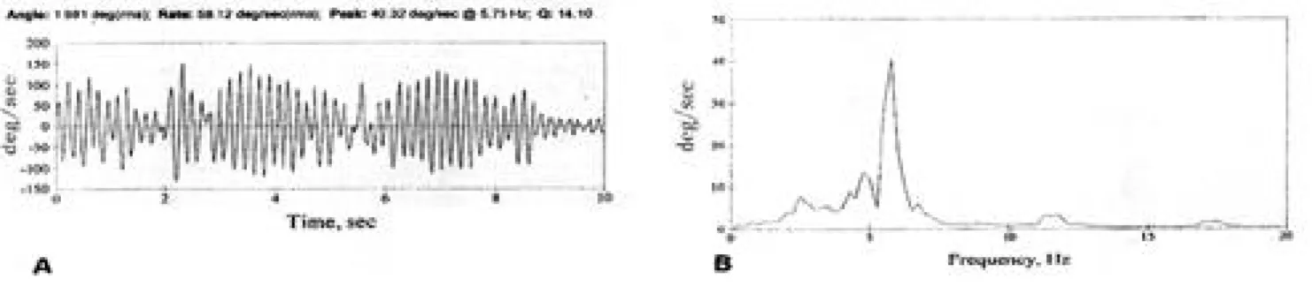 Figure 2. The angular rate strip chart(A) and the frequency spectrum strip chart(B) were measured in right hand after mechanical stimula - -tion