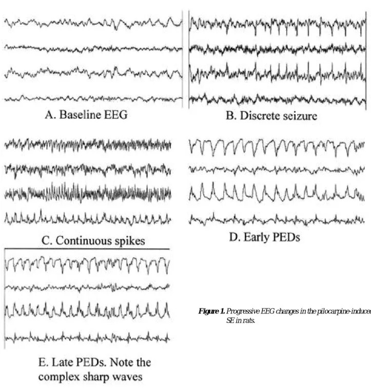 Figure 1. Progressive EEG changes in the pilocarpine-induced SE in rats.