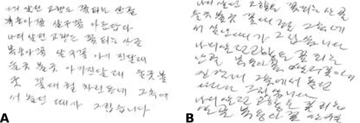Figure 2. The sample of angular rate strip chart at fast writing speed in primary writing tremor type A