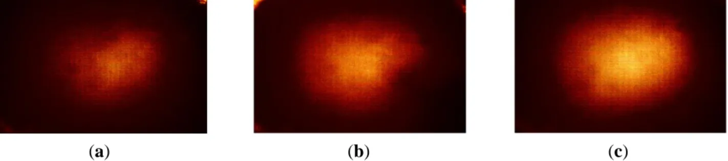 Figure  9.  The  tactile  sensation  image  of  three  inclusions  embedded  in  the  size  phantom: 
