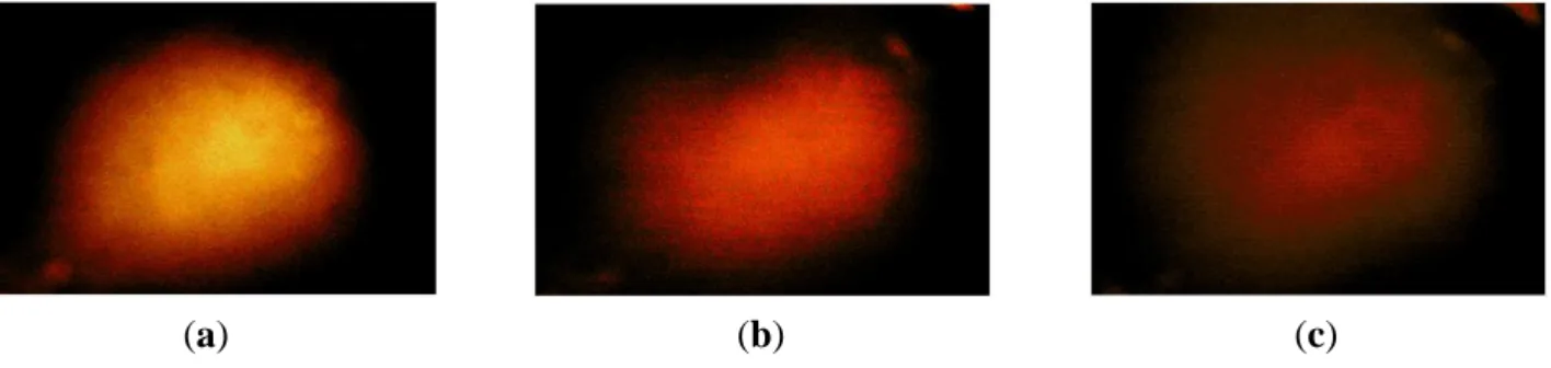 Figure  12.  Tactile  sensation  images  of  three  inclusions  embedded  in  the  depth  phantom: 