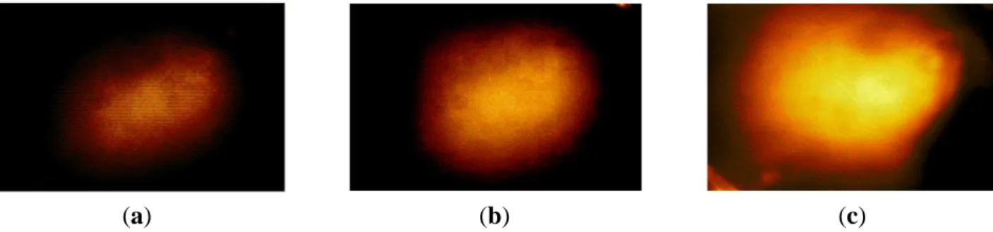 Figure  15.  Tactile  sensation  images  of  three  inclusions  embedded  in  the  hardness  phantom:  (a)  44.5  kPa  Young’s  modulus  inclusion,  (b)  63.5  kPa  Young’s  modulus  inclusion, (c) 102.8 kPa Young’s modulus inclusion