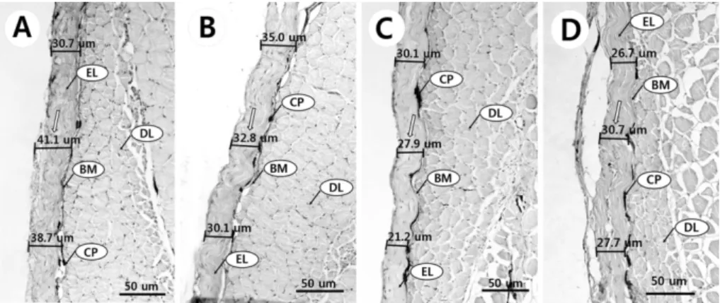 Fig.  5.  Histological  changes  of  Z.  koreanus  integument.  A:  normal  integument,  B:  integument  exposed  for  2  day  in  dissolved  cement  powder,  C:  integument  exposed  for  4  day  in  dissolved  cement  powder,  D:  integument  exposed  fo