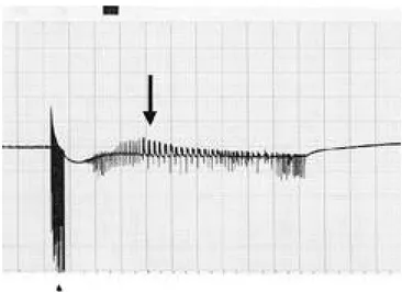Figure 3. Electrically triggered seizure induced in CA1 area of organotypical hippocampal explant culture of rat
