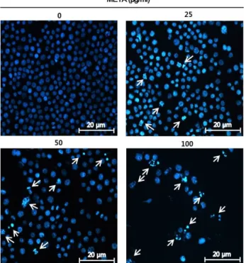 Fig.  5.  Apoptotic  morphological  changes  of  HT29  cells  by  META  treatment.  META-treated  cells  were  fixed  with  4%   form-aldehyde,  permeabilized  with  0.5%  Triton  X-100  and  stained  with  DAPI  for  20  min