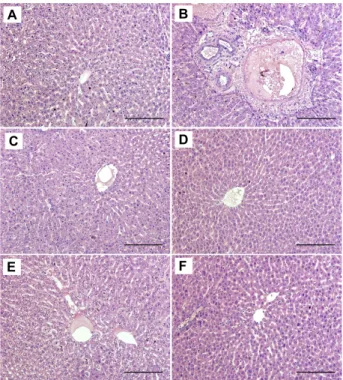 Table  2.  Changes  in  body  weight  and  liver  weight  in  ex- ex-perimental  group Group Weight  (g) Body Liver Control GalN 1) Silymarin UDCA SL-300 2) SL-800 3) 193.2±8.1   188.3±4.6 +197.5±4.4196.5±7.3194.6±6.0  193.2±3.2* 6.4±0.5  5.9±0.1 ++6.2±0.4