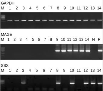 Table 2. Common primers of SSX 1-9 for nested PCR
