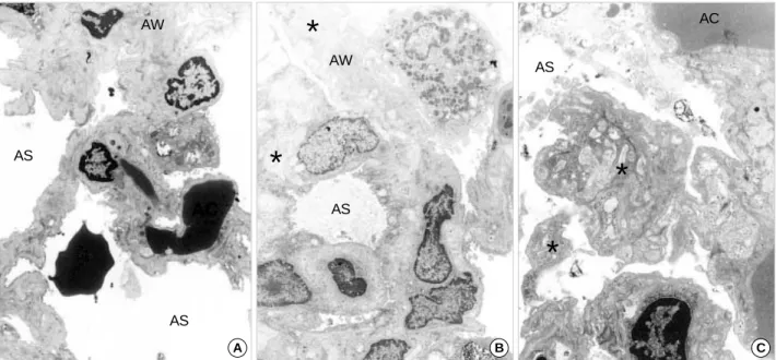 Fig. 3. Transmission electron micrographs of the rat lungs at 12 h after irradiation in different radiation doses