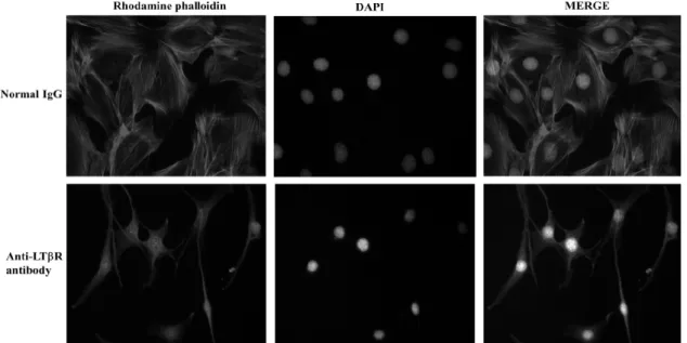 Fig.  1.  LTβR  stimulation  induced  the  change  of  FRC  stress  fiber  morphology  and  cell  shape