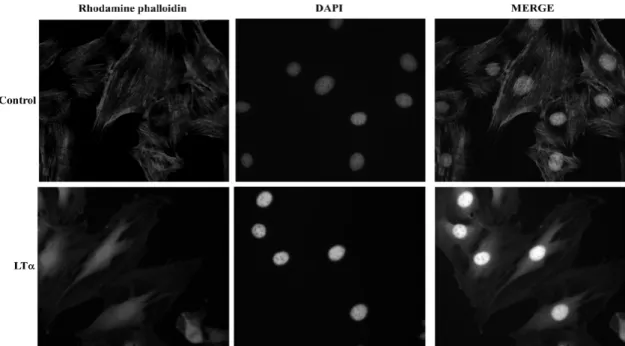 Fig.  2.  LTα partially  disrupted  stress  fiber.  FRCs  were  treated  LTα (10  ng/ml)  for  24  hr,  fixed,  washed  and  stained  for  actin  stress  fiber