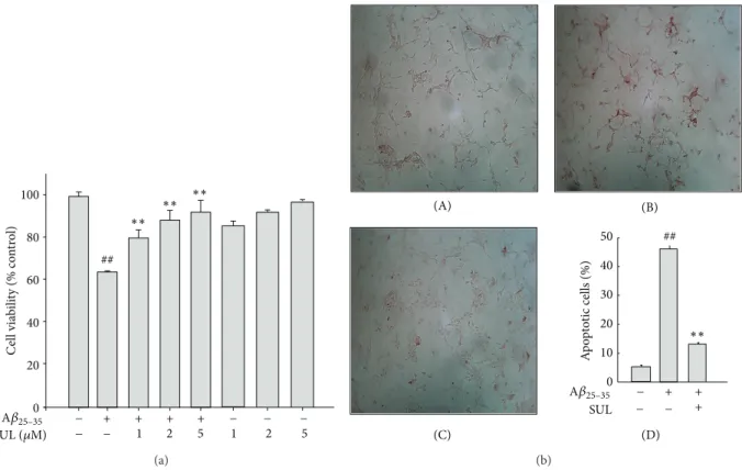 Figure 1: Protective effect of sulforaphane (SUL) on A