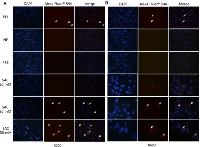 Fig.  4.  Effects  of  SAC  on  in  situ  DNA  fragmentation  of  HeLa  as  measured  by  TUNEL  assay