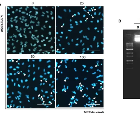 Fig.  4.  Induction  of  apoptosis  by  MEEA  treatment  in  A549.  The  cells  were  treated  with  the  indicated  concentration  of  MEEA  for  48  hr