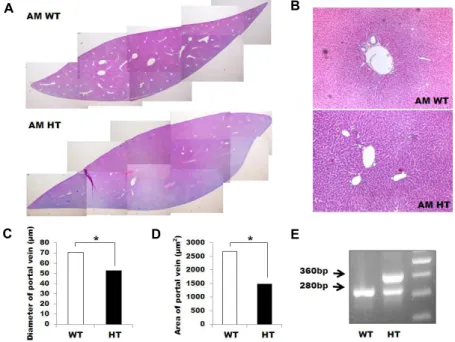 Fig.  1.  Histopathologic  characteristics  of  AM  transgenic  mouse.  (A)  Histologic   pic-ture  of  control  group  mouse  liver