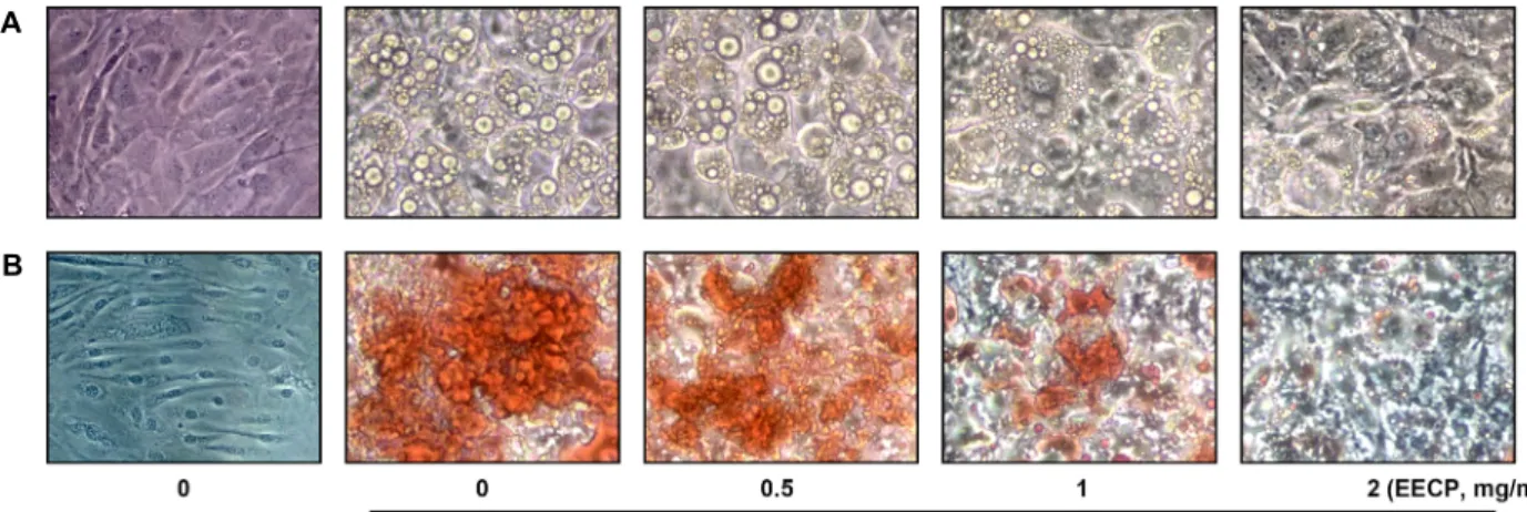 Fig.  2. Effects  of  EECP  on  the  microscopic  morphological  changes  and  lipid  droplet  accumulation  of  differentiated  3T3-L1  mouse  preadipocytes