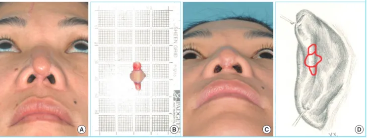 Fig. 3. Case 3