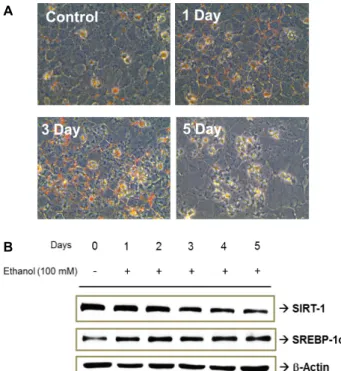 Fig.  1. Alcohol-induced  lipid  accumulation  in  AML-12  cells. 