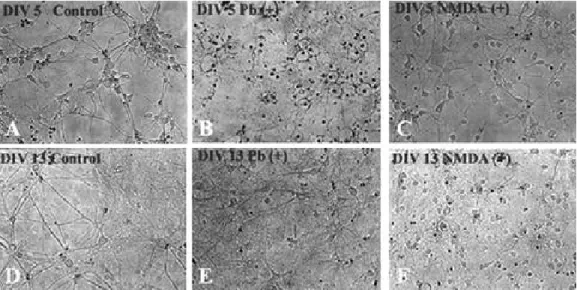 Fig. 3. Photomicrograph of hippocampal neuronal cells DIV 5 (A, B, C) and 13 (D, E, F) of normal controls (A, D), 50 μ mol/L Pb exposed (B, E), and 300 μ mol/L NMDA for 30 min treated (C, F) rats (× 20)