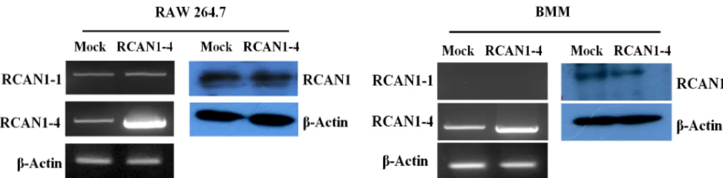 Fig.  2.  Expression  of  RCAN1  mRNA  and  its  protein  after  RCAN1-4  transfection  in  RAW  264.7  cells  and  BMMs