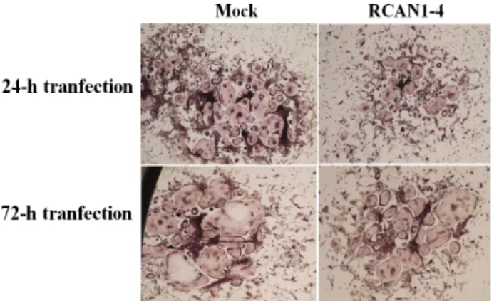 Fig.  4.  Effect  of  transient  over-expression  of  RCAN1-4  on  osteo- osteo-clast  differentiation  in  BMMs
