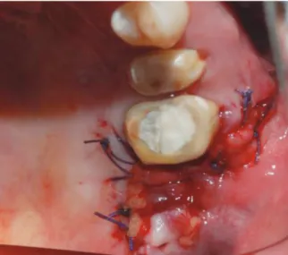 Fig. 6.  Two months after surgery.