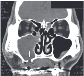 Fig. 10.   Dental panoramic view.
