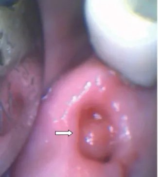 Fig. 11.  1 month after treatment.