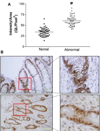 Fig.  2.  Localization  of  expressed  HuR  in  mouse  colitis.  (A)  The  cytosolic  HuR  expression  in  the  small  intestines  on  0  and  3 rd   day  after  DSS  treatment