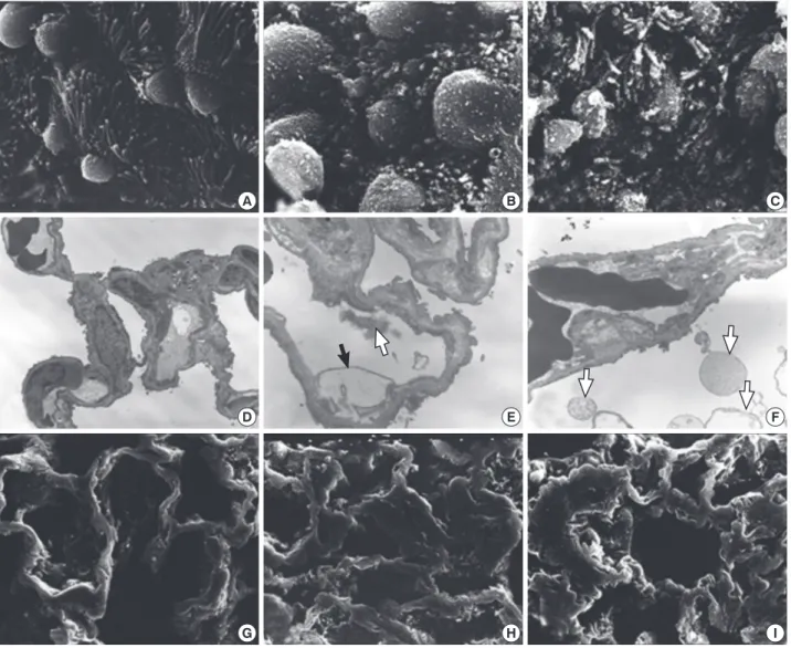 Fig. 3. Ultrastructural changes in lungs exposed to sidestream smoke. (A-C) Scanning electron microscopy (SEM) of the bronchiolar mucosa  shows a marked destruction and a loss of the cilia of the epithelial cells, and an irregular distribution of the Clara