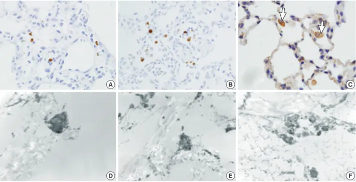 Fig. 5. Light microscopy (LM) and electron microscopic (EM) terminal deoxynucleotidyl transferase dUTP nick end labeling (TUNEL) staining  for apoptotic cells