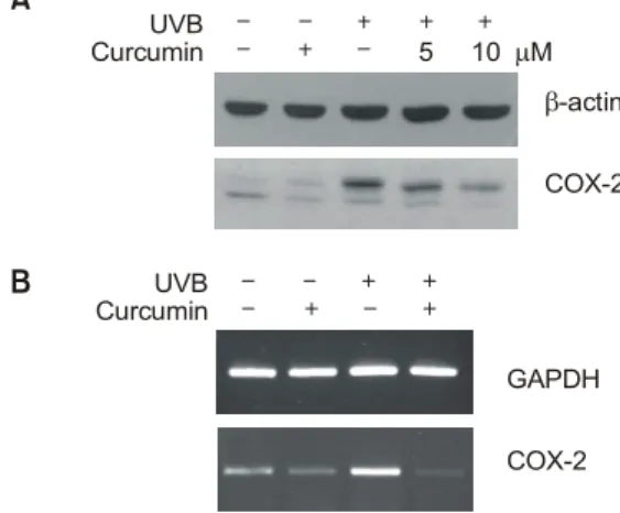 Figure 3. Inhibition of UVB-induced COX-2 expression by MAPKs  inhi-bitors. (A) After UVB irradiation  (200 mJ/cm 2 ), the cells were  har-vested at indicated times