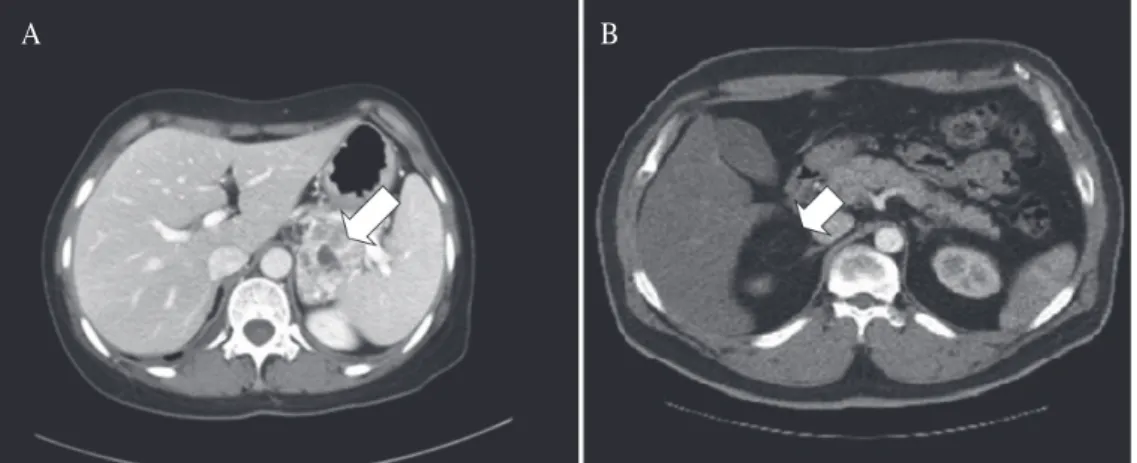 Fig. 2.    Gross finding of the mass showed irregular 