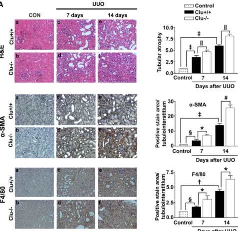 Figure 3. Loss of clusterin accelerated renal ﬁbrosis after UUO. (A) Representative images of H&amp;E and immunohistochemical staining for a-SMA and F4/80 of the renal cortex in kidney tissue sections from unobstructed Clu +/+ and Clu 2/2 , Clu +/+ and Clu