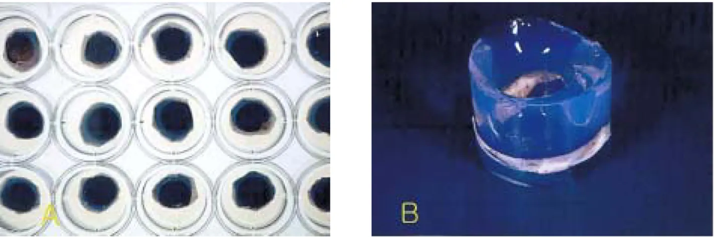 Figure 1. Preparing bruch's membrane explants. (A) 24 well containing explants sealed with agarose, (B) an explant-agarose  block.