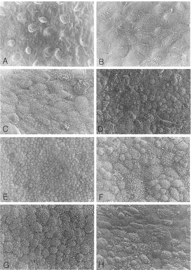 Figure 5. Scanning electron microscopic photographs of SC transplants cultured on BM. RPE cells proliferated to form a  monolayer in polygonal shape, but showed variable size of cells