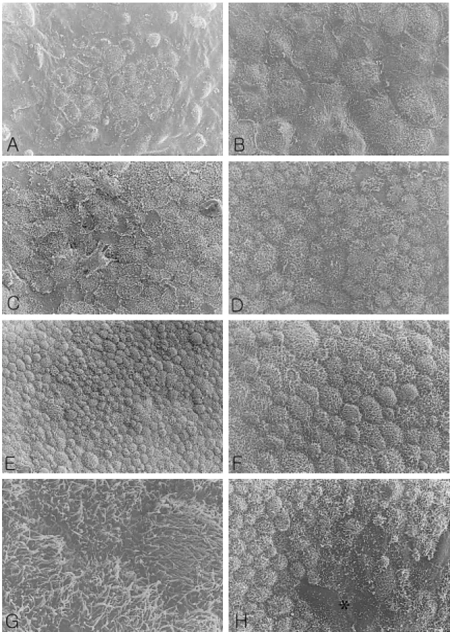 Figure 7. Scanning electron microscopic photographs of CC transplants cultured on BM. Cultured RPE cell obtained much  polygonal shape in comparing with SC tissue
