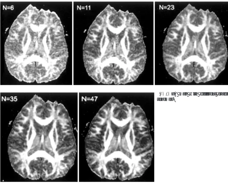 Fig.  1. FA map with different gradient schemes.