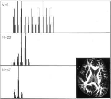 Table  1. Fractional Anisotropy and Standard Deviation of Fractional Anisotropy on Different Diffusion Tensor Imaging Schemes (p<0.05)