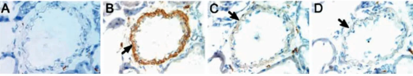 Figure 2: Localization of SBP-1 to SMC in vivo. Immunohistochemical labeling was performed using normal rabbit serum (A) or affinity purified rabbit polyclonal anti-SBP-1 Ab (B)–(D)