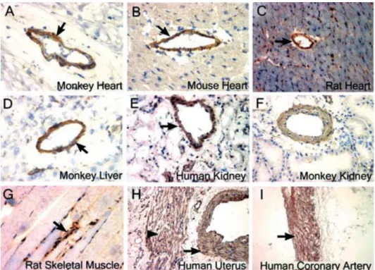 Figure 3: SBP-1 is local- local-ized primarily to SMC in vivo. Immunohistochemical labeling was performed  us-ing affinity purified rabbit polyclonal anti-SBP-1 Ab (A)–