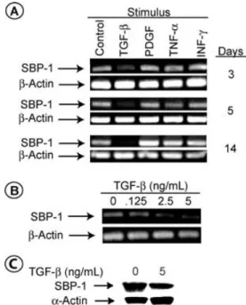 Figure 8: TGF-b downregulates the expression of SBP-1.