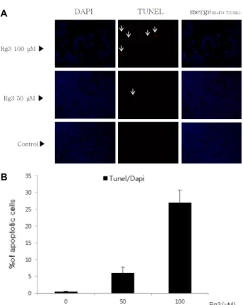Fig. 5. Effects of ginsenoside Rg3 on protein expression related to apoptosis. After treatment with ginsenoside Rg3 (0, 20, 40, 80, 100 μM) concentrations and for 48hr, the cells were lysed and performed to western blotting