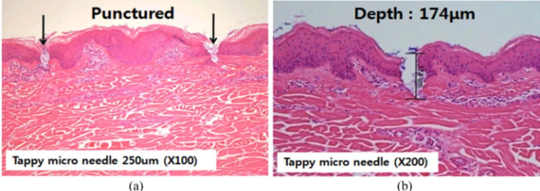 Fig. 6. SEM image of punctured porcine skin by Tappy ® tapping