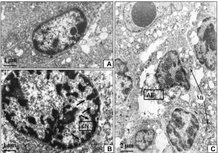Fig. 6. Transmission electron micrograph of the ex- ex-planted-tumor cell after treated with GLP in Sarcoma 180-bearing mice