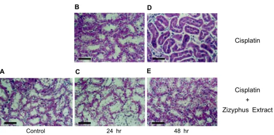 Fig. 4. Effect of Zizyphus Extract pretreatment on change in lipid peroxidation of cortex of kidney in cisplatin-induecd acute renal failure