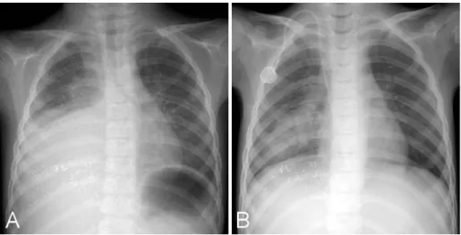 Fig. 2. Chest CT on admission showed 63×72×