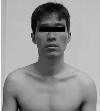 Fig. 1. Gray-blue discoloration of the face and neck